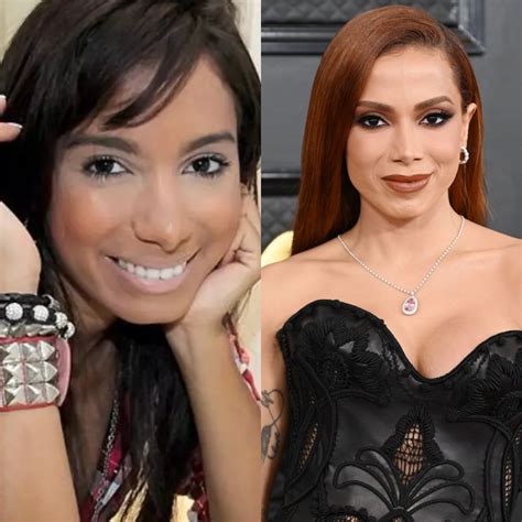 anitta|anitta antes e depois.
